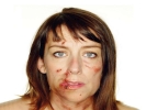 domestic violence woman cut lip large landscape white bg 1024x768