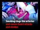 clogs arteries causes heart attacks 1024x768