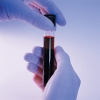 blood in test tube surgical gloves med