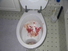 nose bleed in toilet med 800x600