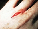 real cut on hand bleeding med 800x600