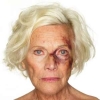 domestic violence elderly woman black eye small square white bg 300x300