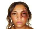 domestic violence woman black eye 2 large landscape white bg 1024x768