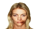 domestic violence woman cut lip 3 large landscape white bg 1024x768