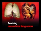fatal lung cancer 1024x768