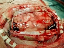 caution brain operation on phy abused child 800x600